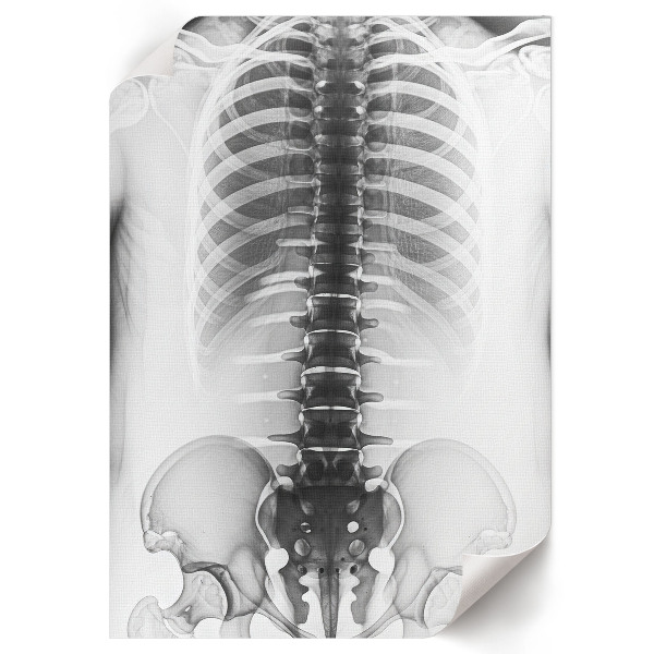 X-ray poster