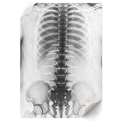 Poster X-ray