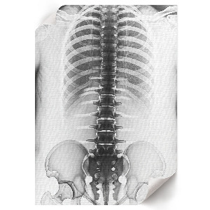 X-ray poster