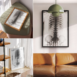 X-ray poster